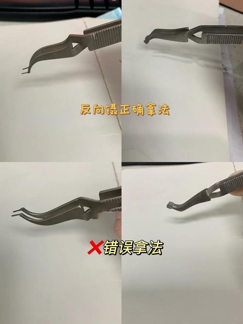 口腔正畸托槽粘贴如何实现精准定位与牢固粘贴？-图1