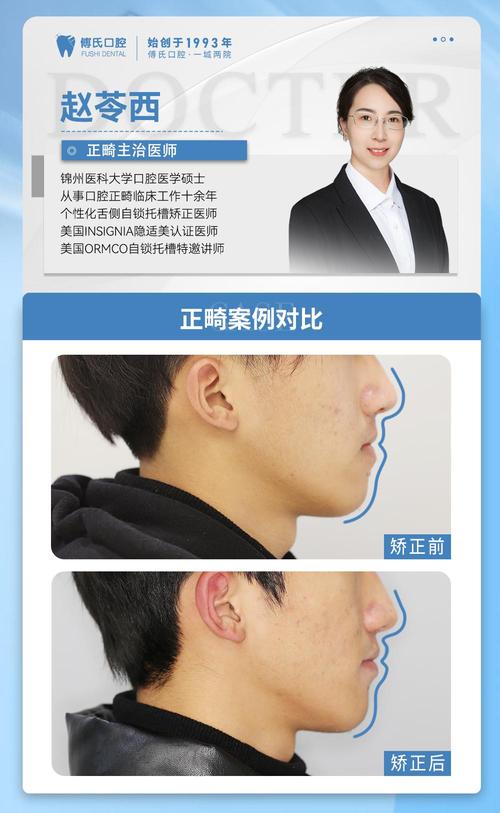 男生牙齿正畸案例效果如何？矫正过程复杂吗？-图1