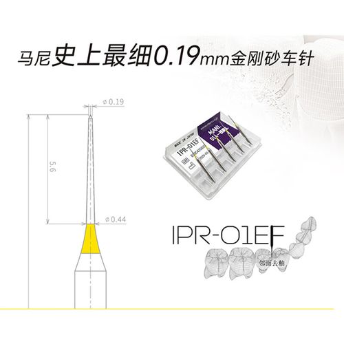 正畸ipr有误差-图1