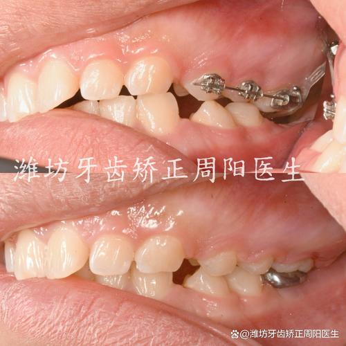 精于种植专于正畸-图2 精于种植专于正畸-图2