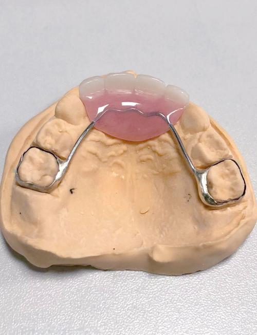 正畸关闭间隙材料-图1