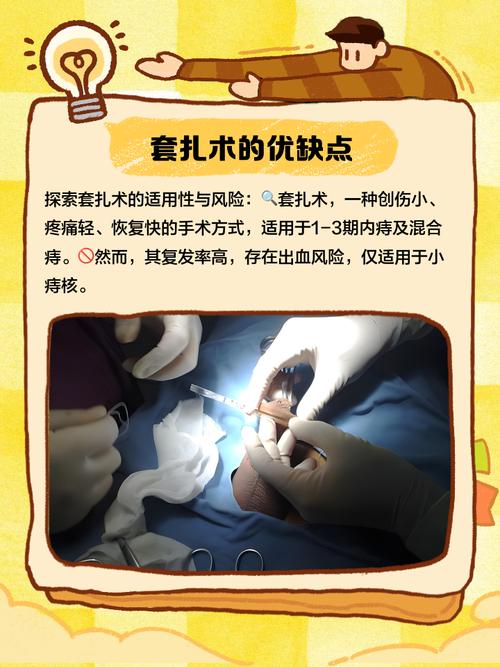 正畸连续结扎方法-图2