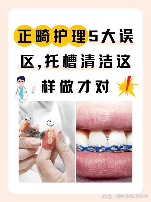 正畸期间怎么清洁-图3 正畸期间怎么清洁-图3