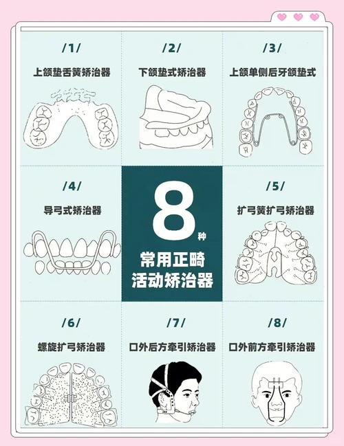 口腔正畸矫治体系-图3
