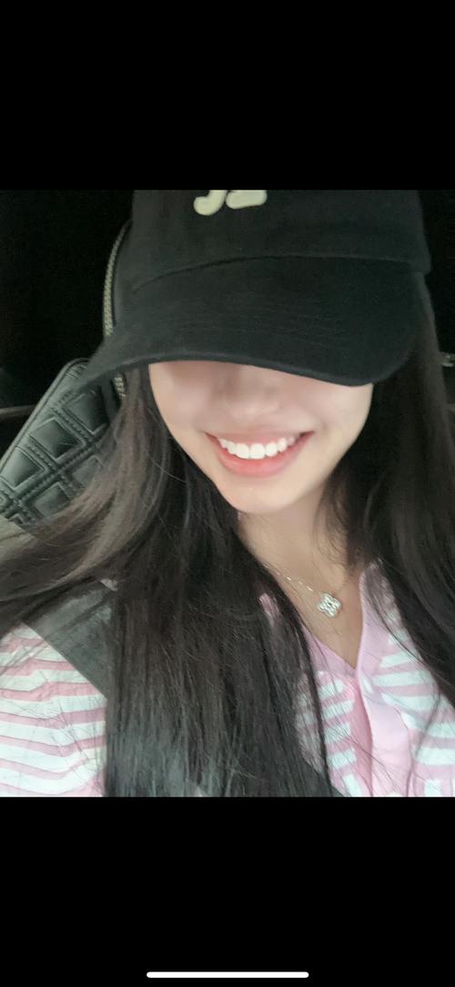 时代隐形正畸牙齿-图2