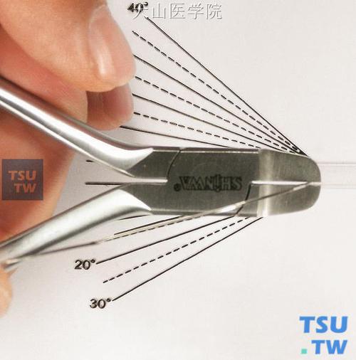 口腔正畸转矩，临床应用技巧如何精准掌握？-图2