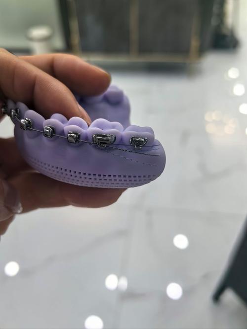 牙科正畸模型展示-图1 牙科正畸模型展示-图1