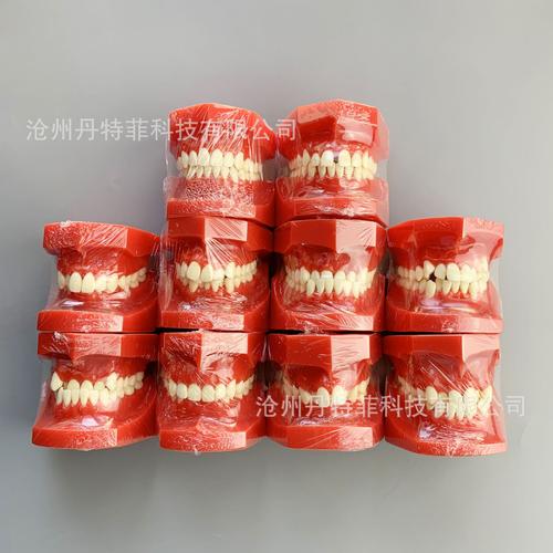 牙科正畸模型展示-图3 牙科正畸模型展示-图3