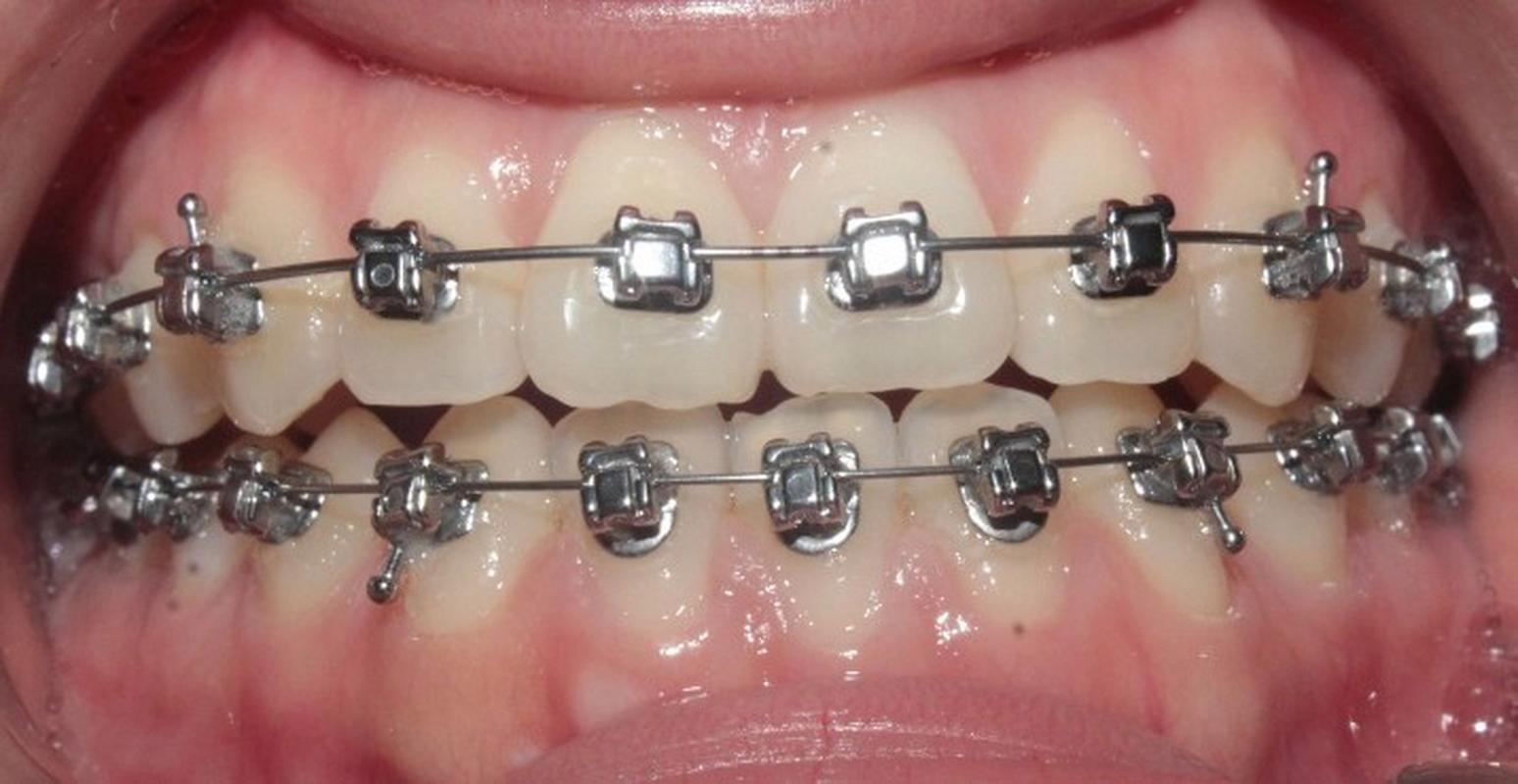 龙岩牙齿正畸去哪里做？求推荐靠谱口腔机构-图1