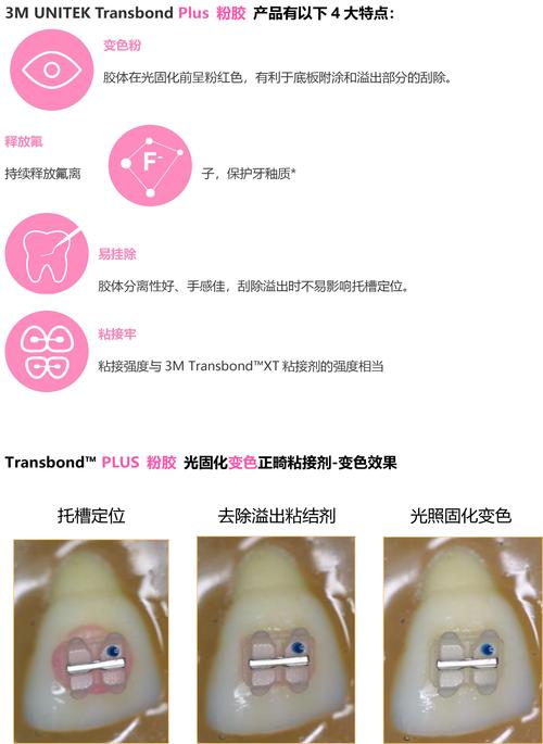 正畸牙釉质粘接剂残留如何安全清除？-图3