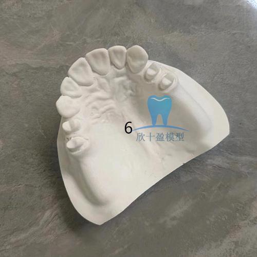 正畸石膏模型拍照-图2