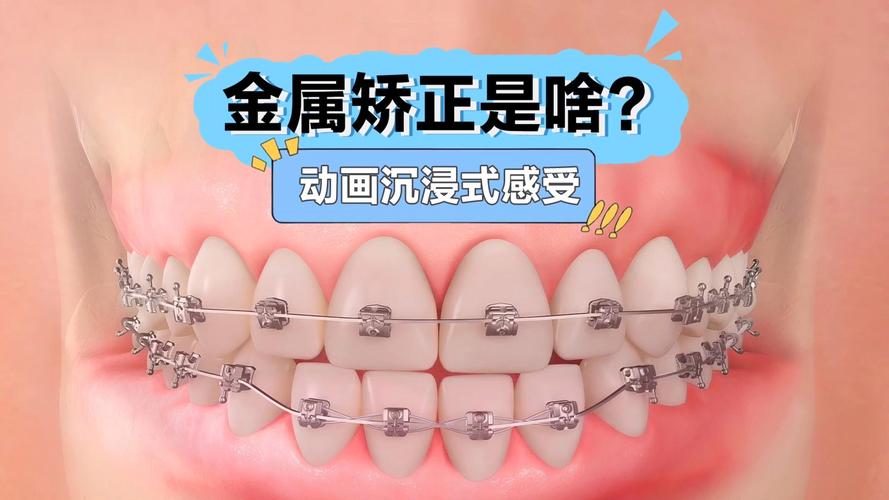 正畸托槽的PPT-图1