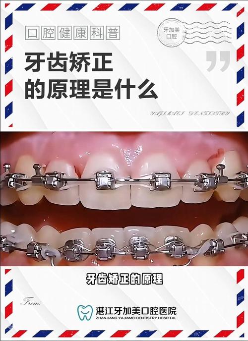 正畸托槽的PPT-图2