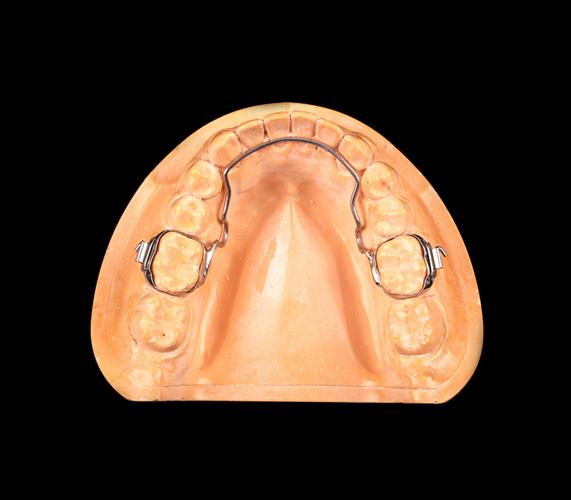 meaw弓 正畸-图3 meaw弓 正畸-图3