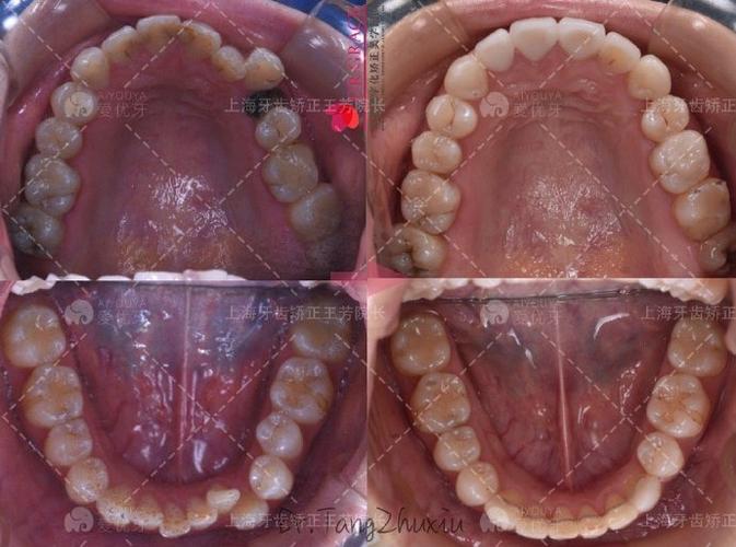 正畸 上海 武汉-图3