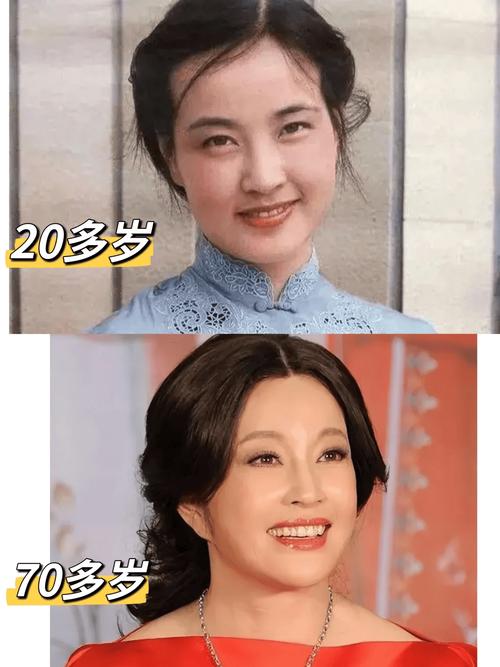 刘晓庆牙齿正畸引热议，高龄选择矫正背后的原因是什么？-图1