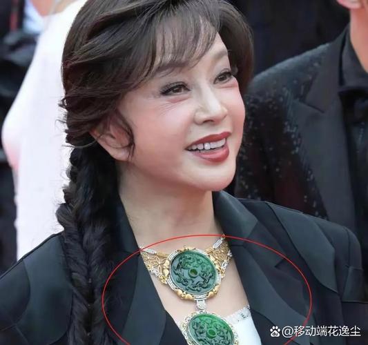 刘晓庆牙齿正畸引热议，高龄选择矫正背后的原因是什么？-图2