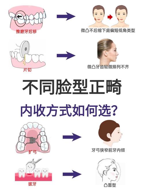 如何准确判断正畸力大小？-图3
