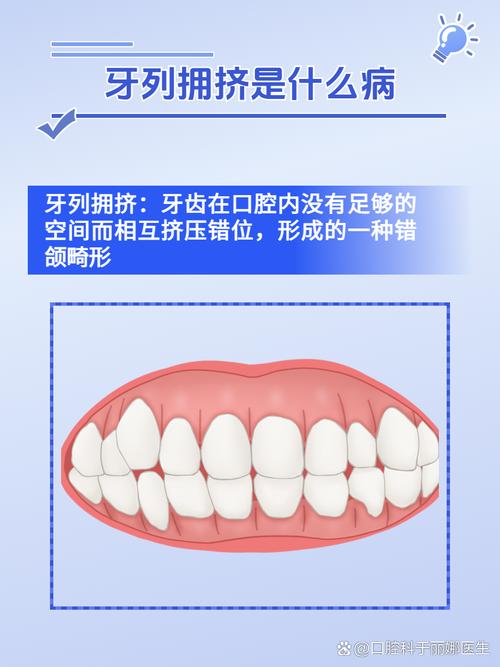 正畸拥挤度正常值是多少？如何判断是否达标？-图2