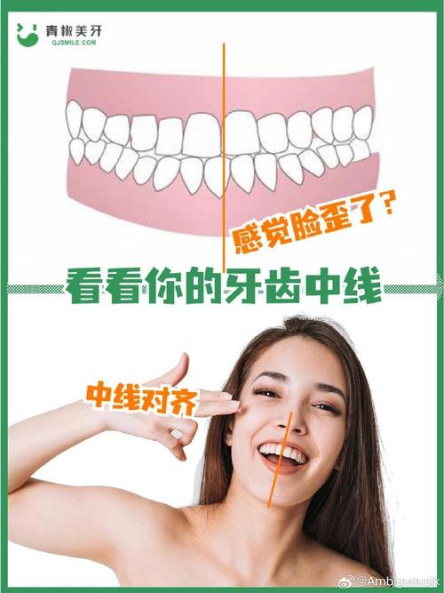 正畸可以对中线吗-图1