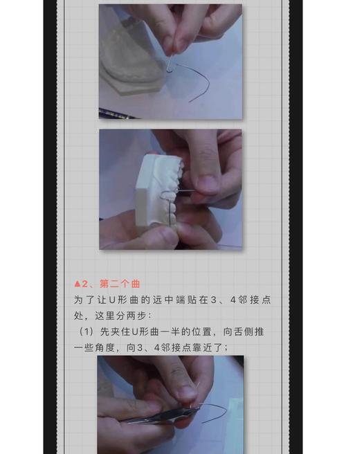 正畸唇弓弯制视频-图1