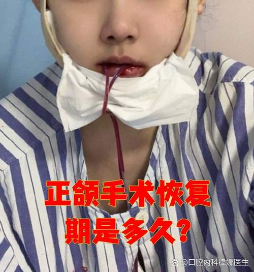 口腔正畸偏额手术-图3