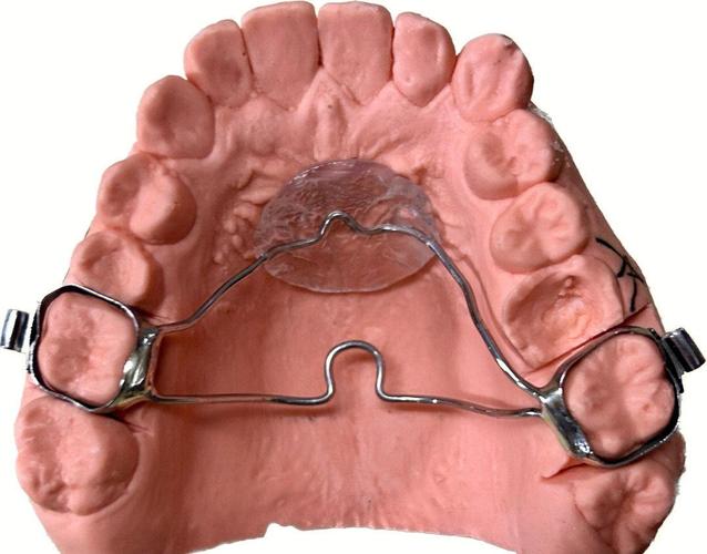 正畸1925弓丝-图2