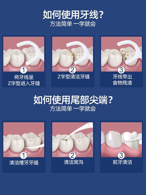 正畸如何使用牙线-图2 正畸如何使用牙线-图2
