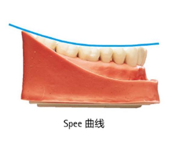 正畸spee曲线-图3