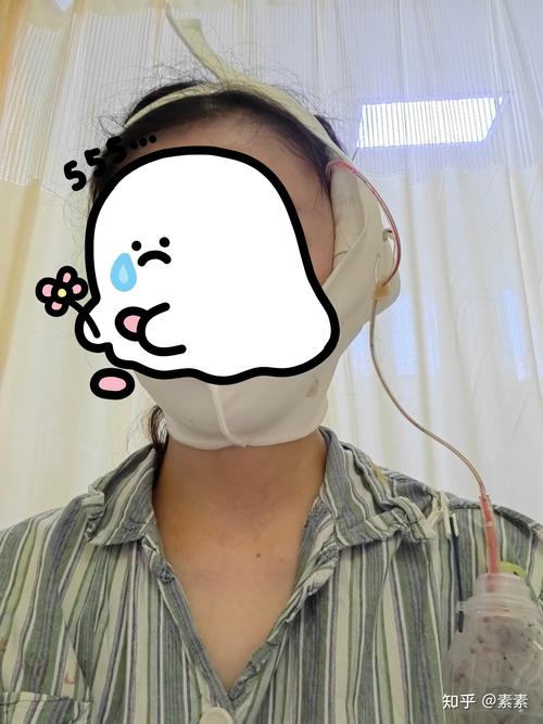 上海九院正畸手术-图3