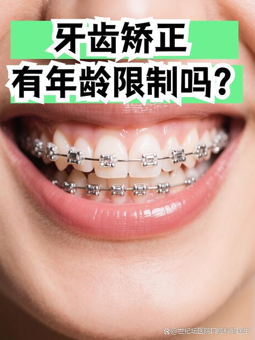 正畸有年龄限制吗-图1