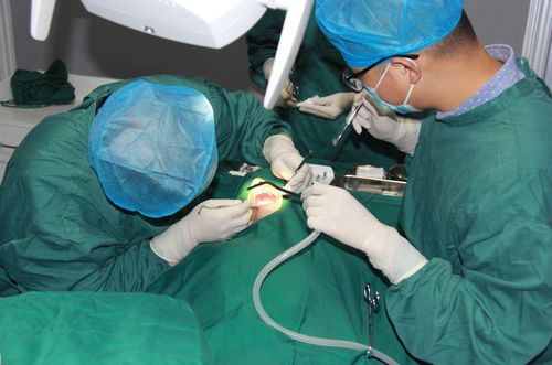 牙齿正畸为何需外科手术？效果与风险如何？-图2