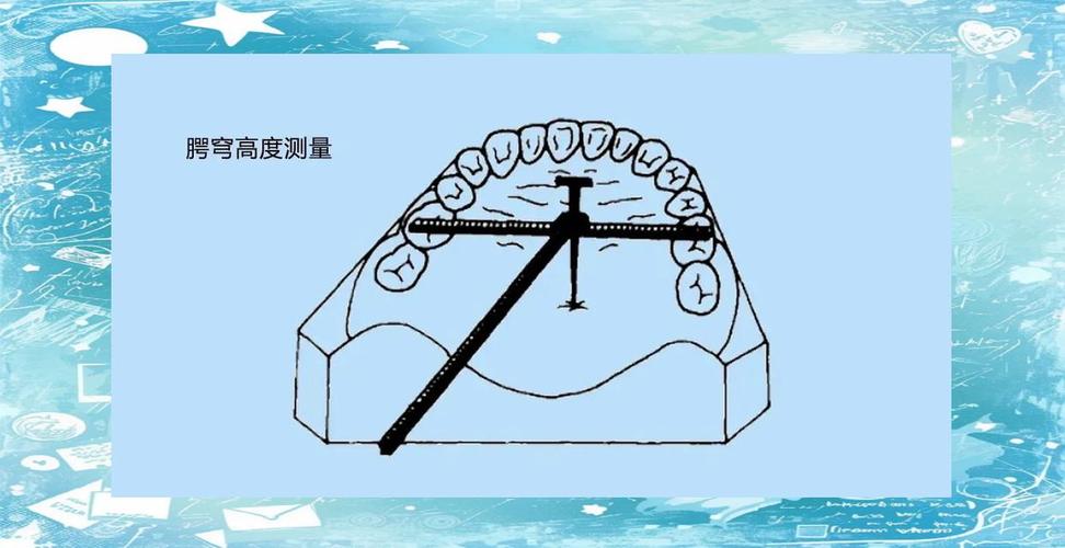 正畸牙弓长度测量-图3