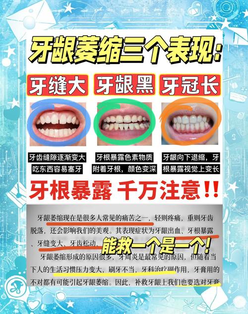 牙龈萎缩能正畸吗-图2