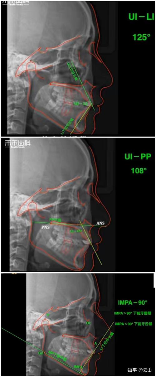口腔正畸头影测量-图2