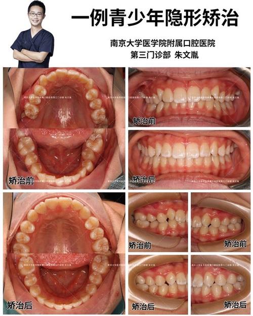苏州口腔医院正畸-图3