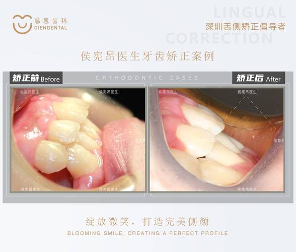 中国医大口腔正畸-图3