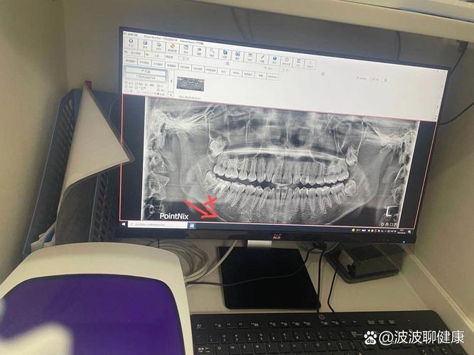 宁波口腔医院正畸-图1