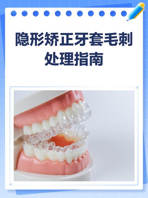 北京 正畸 隐形-图1