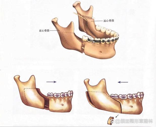 正畸和颞下颌关节-图3