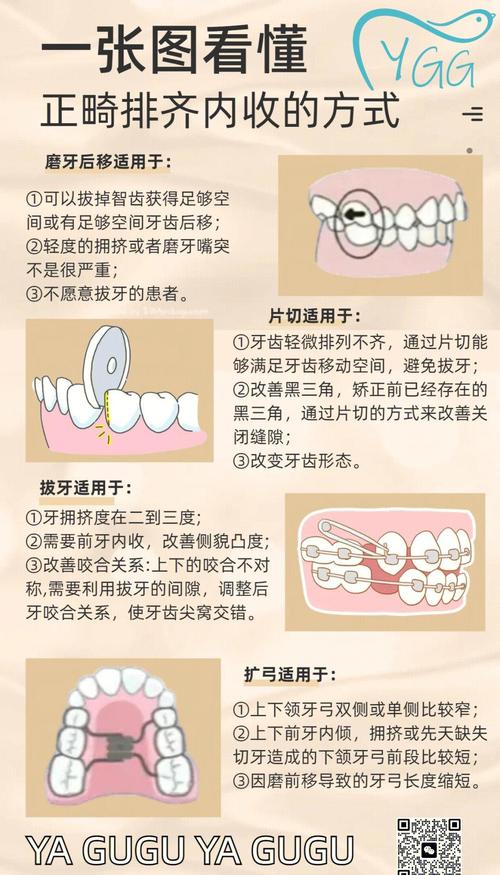 正畸拔牙收缝怎么收？图解步骤全解析，方法在这？-图2