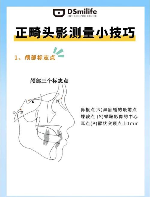 口腔正畸投影测量-图1 口腔正畸投影测量-图1