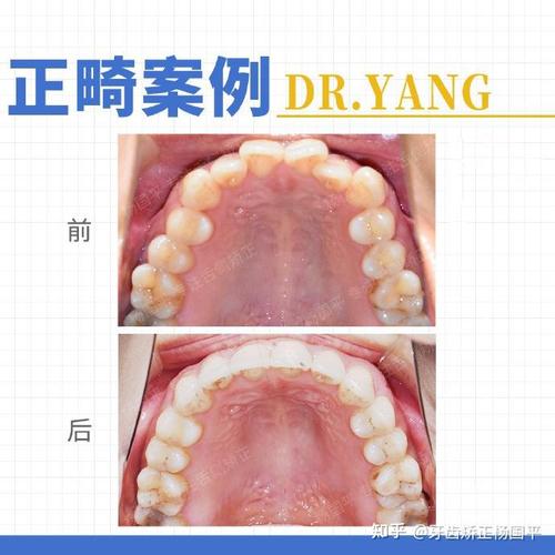 上海九院口腔正畸-图3