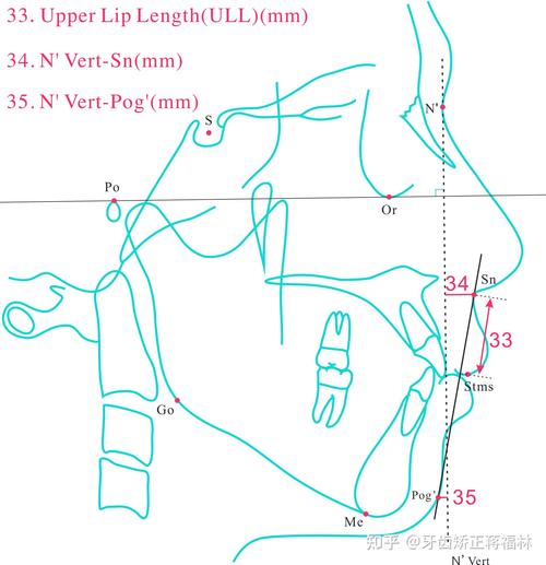 正畸头影测量分析如何辅助正畸精准诊断？-图2