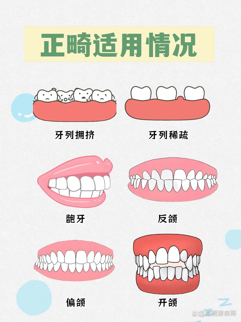 为什么正畸要拔牙-图2