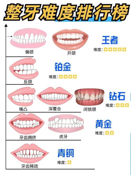 正畸力大小范围-图1