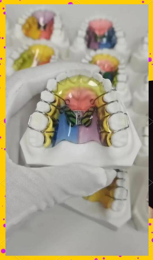 正畸主弓丝扩弓-图2