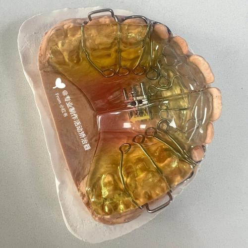 正畸扩弓用弓丝-图3