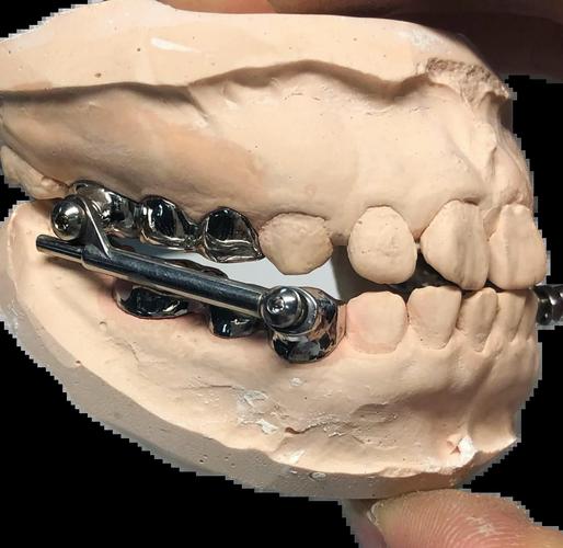 正畸T形曲弯制有哪些关键技巧？-图3