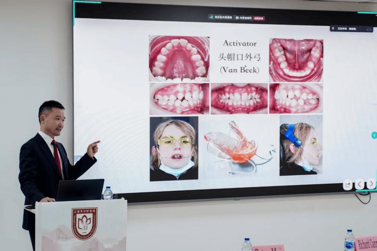 正畸上谁的课好-图2 正畸上谁的课好-图2